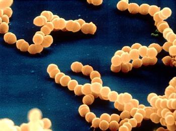 Бактериальний цистит: что нужно знать?
