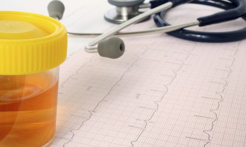 Возможно выделение небольшого количества крови из мочеиспускательного канала