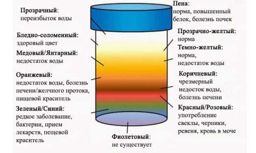 Причины темной мочи могут быть разными, не стоит недооценивать наличие подобного симптома