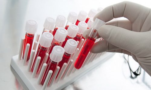 Для того чтобы распознать цистит у ребенка 2 лет, потребуется анализ крови