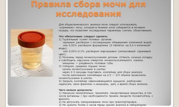 Повышенное количество белка, лейкоцитов и присутствие бактерий в общем анализе мочи является тревожным признаком