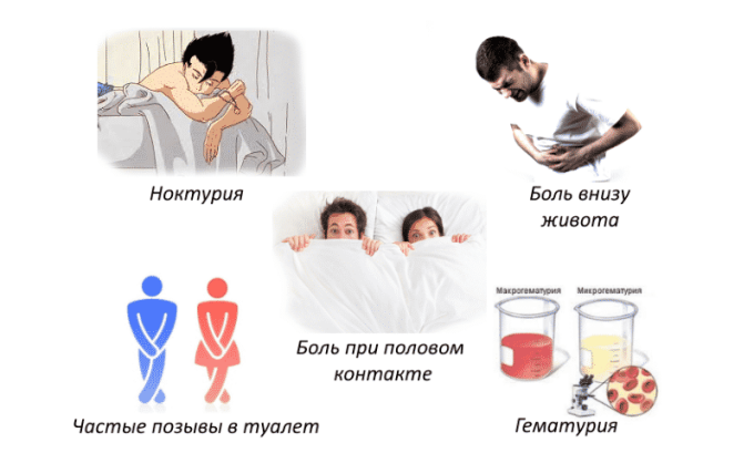 То обстоятельство, что цистит и кандидоз имеют схожую симптоматику, часто становится причиной неправильной диагностики