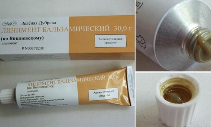 В устранении жжения используют тампоны с мазью Вишневского