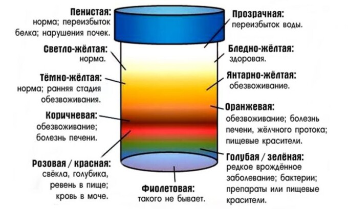 Психосоматический цистит в большинстве случаев не сопровождается выделением урины с кровью